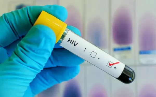 Dezembro Vermelho: São Paulo reduz casos de HIV