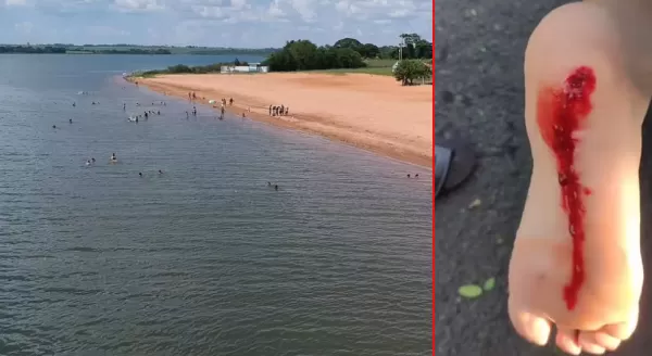 Banhistas sofrem ferimentos após ataque de piranhas em prainha