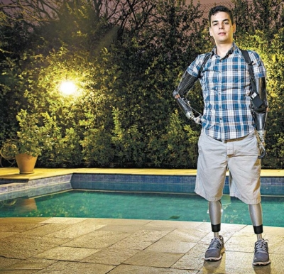 Jovem brasileiro amputado vira símbolo de superação mundo afora