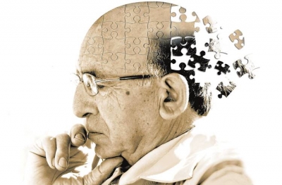 Conheça mais sobre a doença de Alzheimer