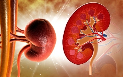 Silenciosa, doença renal crônica atinge 10% da população